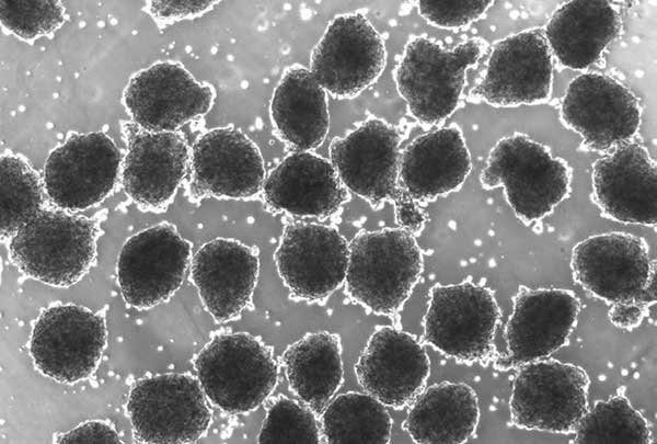 microscopic-image-cardiac-progenitorspheres Microscopic image of cardiac progenitor spheres generated by tissue engineering