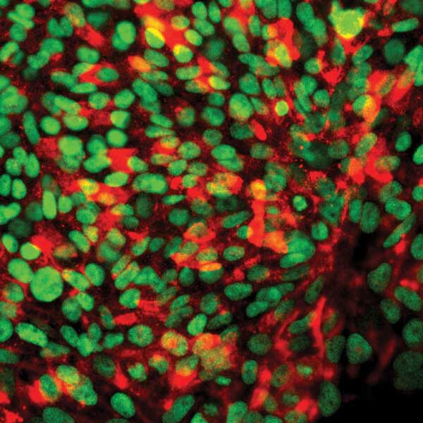 microscopic-image-pluripotent-stemcells