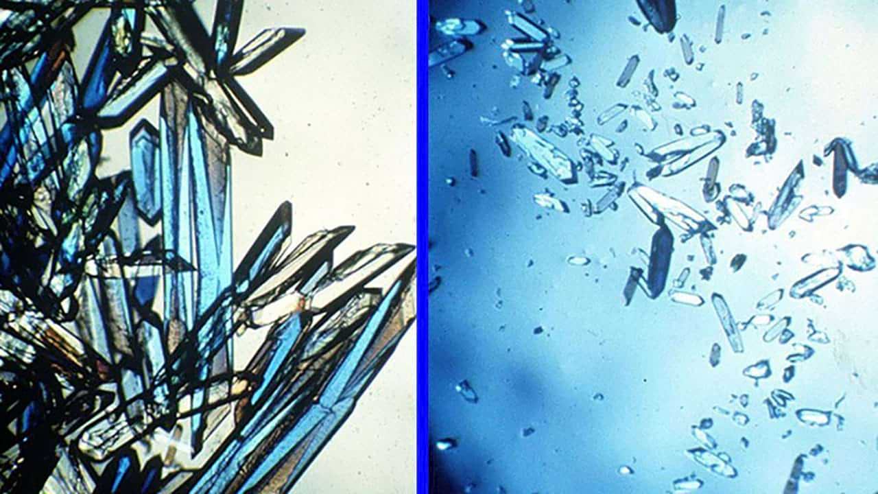A comparison of bovine insulin protein crystals grown in space (left) and on Earth (right).