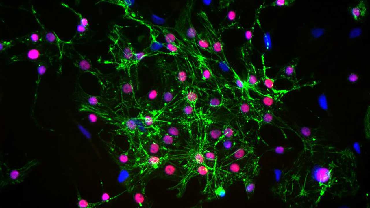 Detection of cardiac structural proteins (stained green) and cardiac transcription factor (stained red) in cells following cryopreservation and carbon dioxide-independent culture. The nuclei are stained blue.