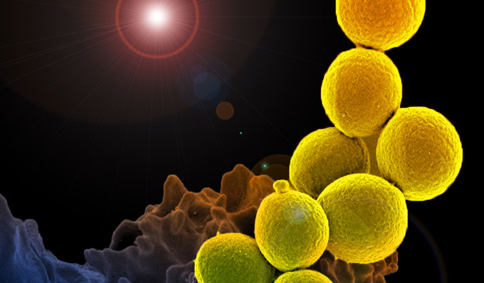 mrsa bacteria 2