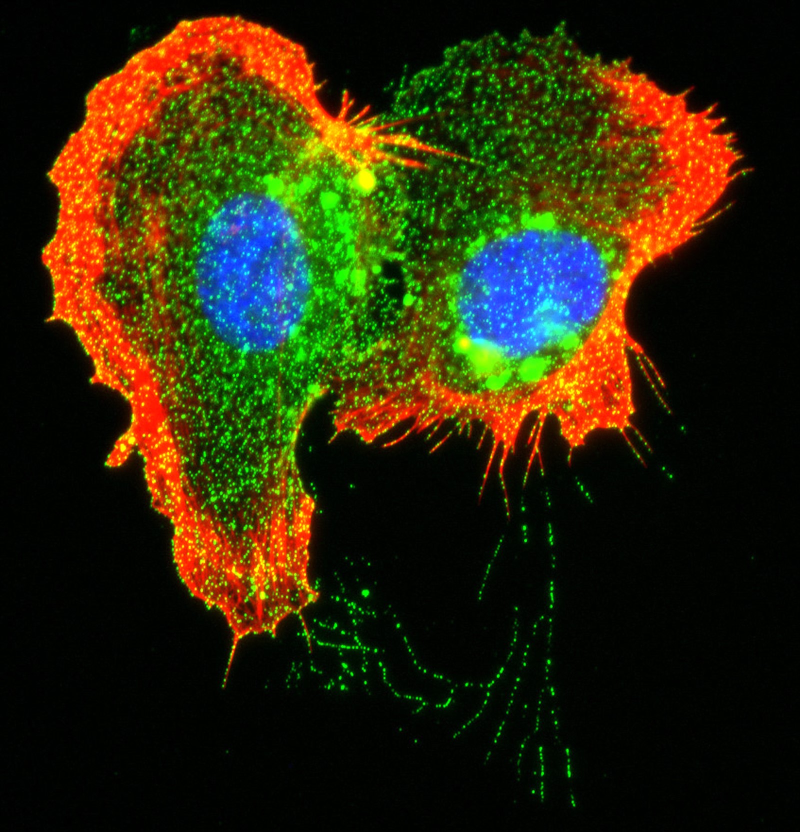 Green labels TM4SF1, the target of Angiexs cancer therapy; red labels the cytoskeleton, the equivalent of bone in cells; blue labels the nucleus. These two endothelial cells interact with one another and are connected by nanopodia, long membrane tubes that appear in this image as a series of green dots. The green dots label the microdomains by which Angiexs drug is delivered into endothelial cells. The drug kills dividing endothelial cells. In adults, endothelial cells rarely divide in normal vessels, but frequently divide in tumors to support tumor growth. By targeting these dividing cells, Angiexs drug can destroy tumor blood vessels, leading to regression of the tumor.