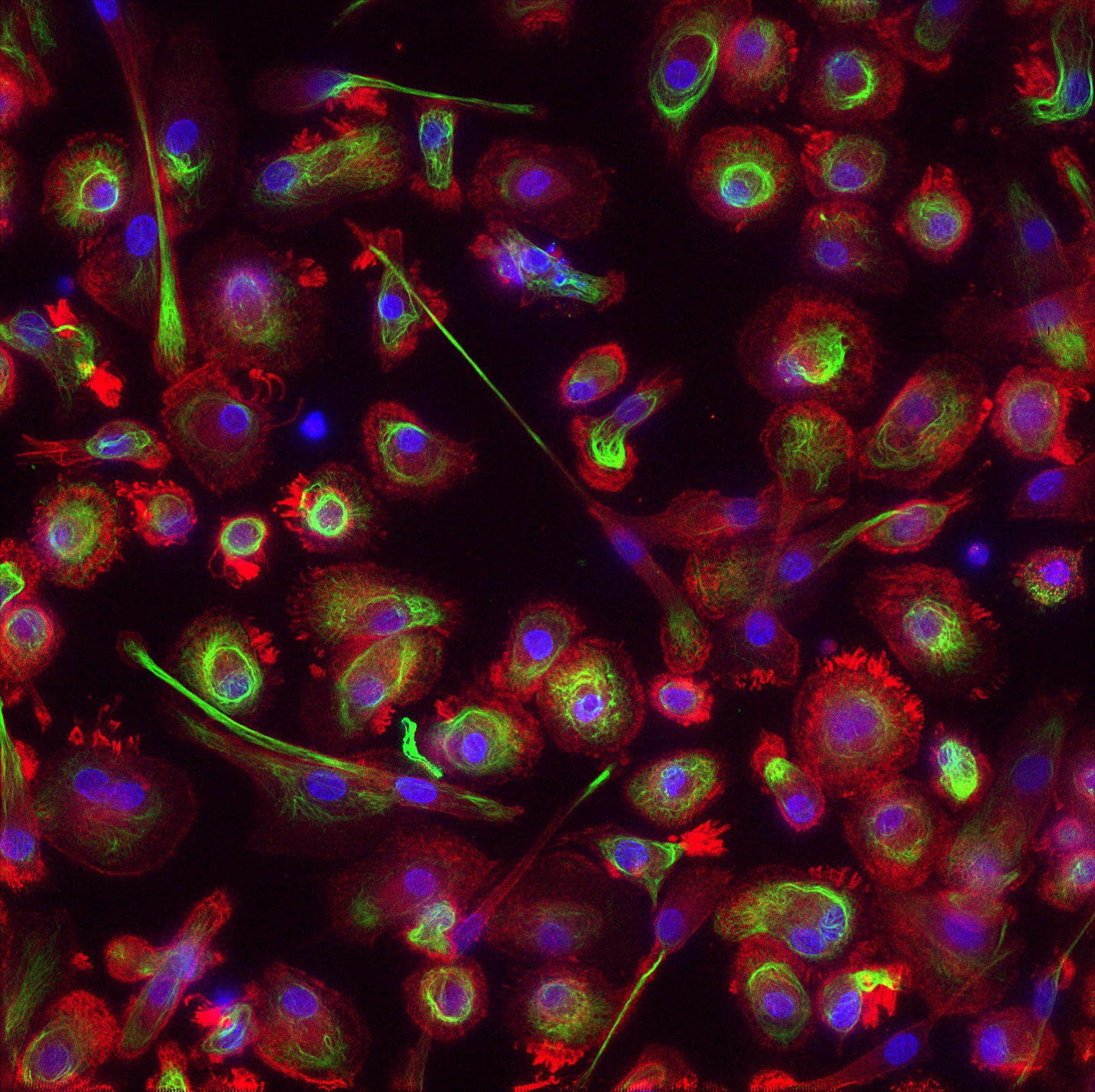 Image of fixed macrophages using three chromophores created by the FLUMIAS DEA miniaturized fluorescence microscope during Science Verification Test.