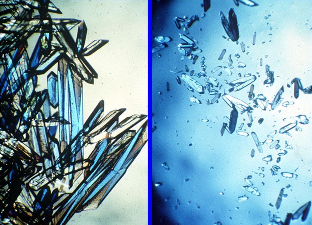 Comparison of space grown (left) and Earth grown (right) protein crystals