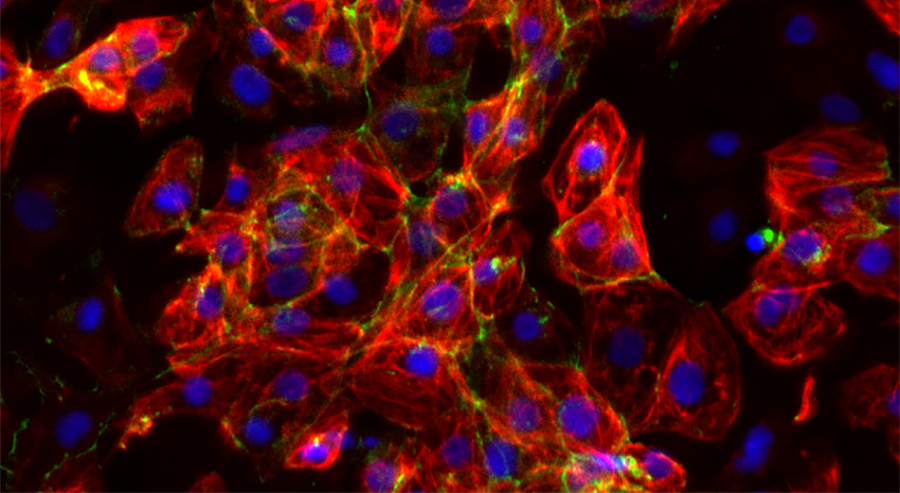 Cardiomyocytes derived from human induced pluripotent stem cells.