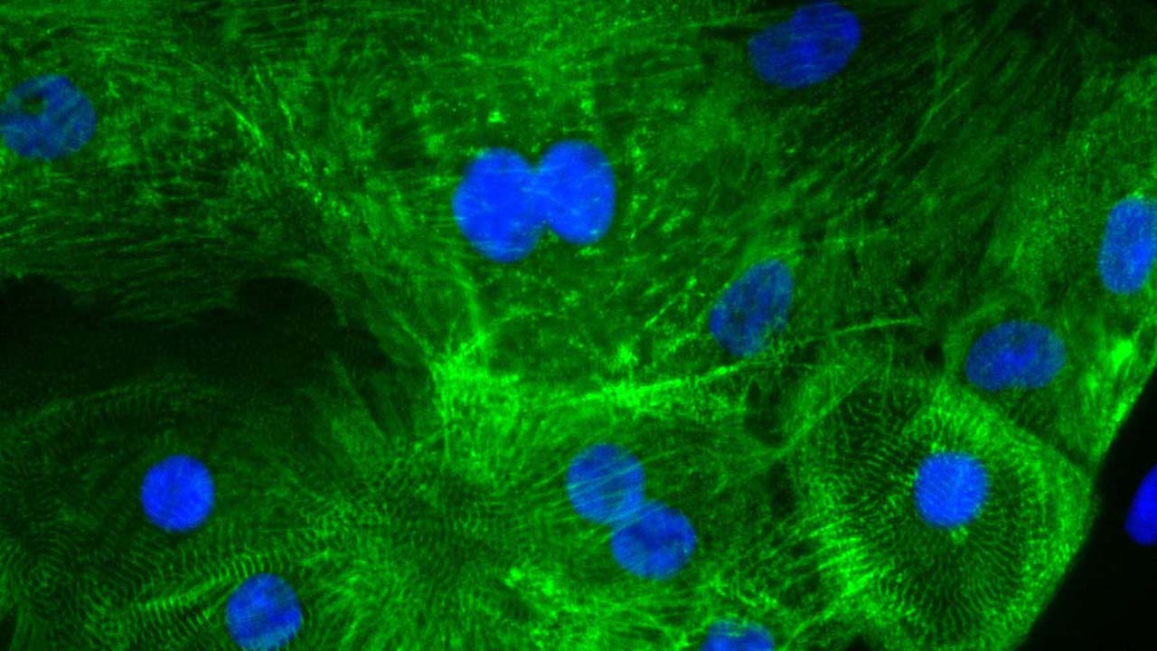 Heart cells derived from human stem cells stained for muscle protein (green) and nuclei (blue).