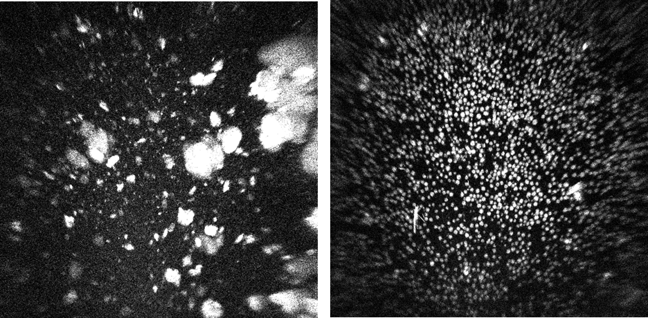 UV imaging of a ground control sample (left) and spaceflight sample (right) from Mercks investigation, clearly showing the much more uniform size and distribution of crystals grown in microgravity.