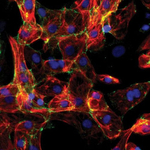 microscopic-image-cardiomyocytes-stem-cells-e1616076606338 Microscopic image of cardiomyocytes derived from human pluripotent stem cells