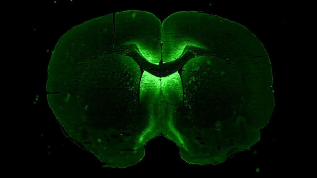 ng19-axonis-3d-brain 3DI neuronal cells cultured in microgravity for Neuronix, which tests a gene therapy for neurological diseases.