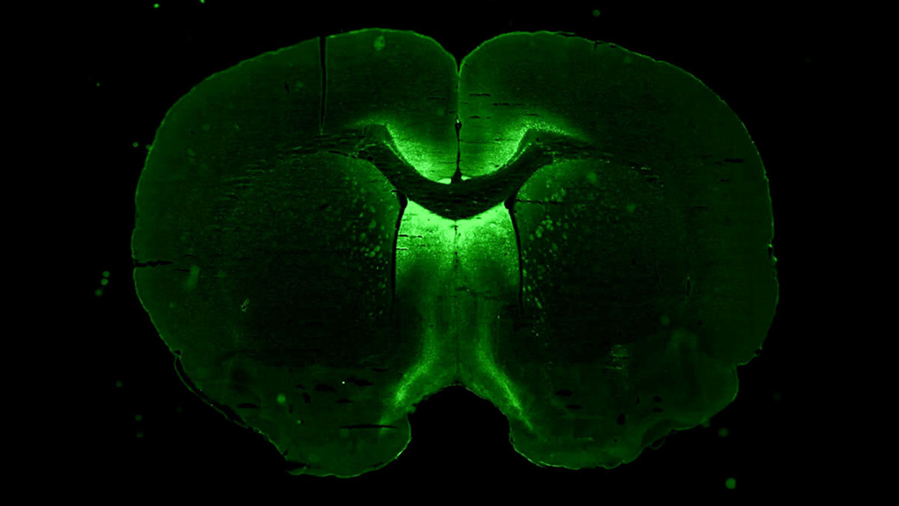 3DI neuronal cells cultured in microgravity for Neuronix, which tests a gene therapy for neurological diseases.