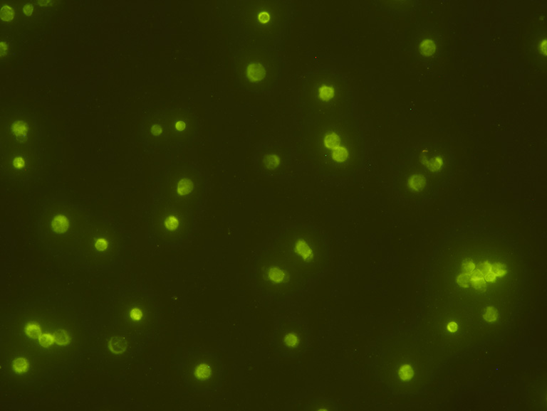 A view of umbilical cord blood hematopoietic stem cells marked with a fluorescent dye.