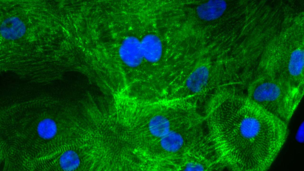 Heart cells derived from human stem cells stained for muscle protein (green) and nuclei (blue).