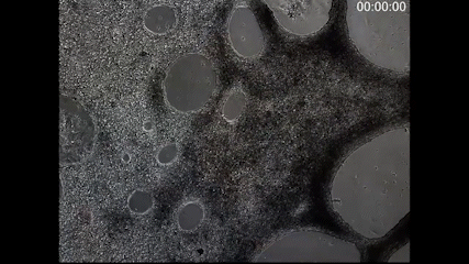 A view of the cardiomyocytes beating under a microscope.