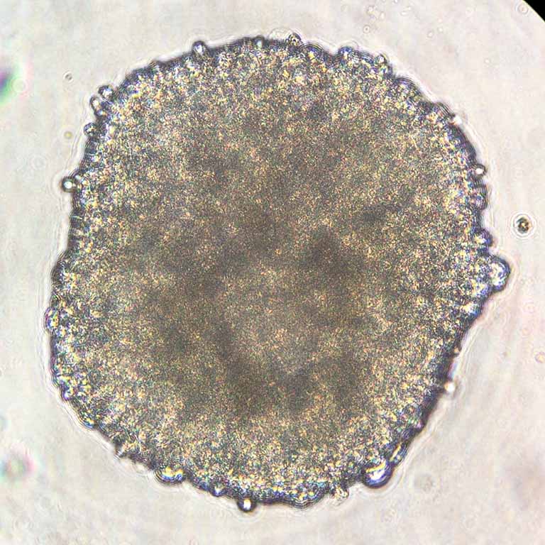 A preflight image of beating cardiac spheroid composed of iPSC derived cardiomyocytes (CMs), endothelial cells (ECs), and cardiac fibroblasts (CFs). 