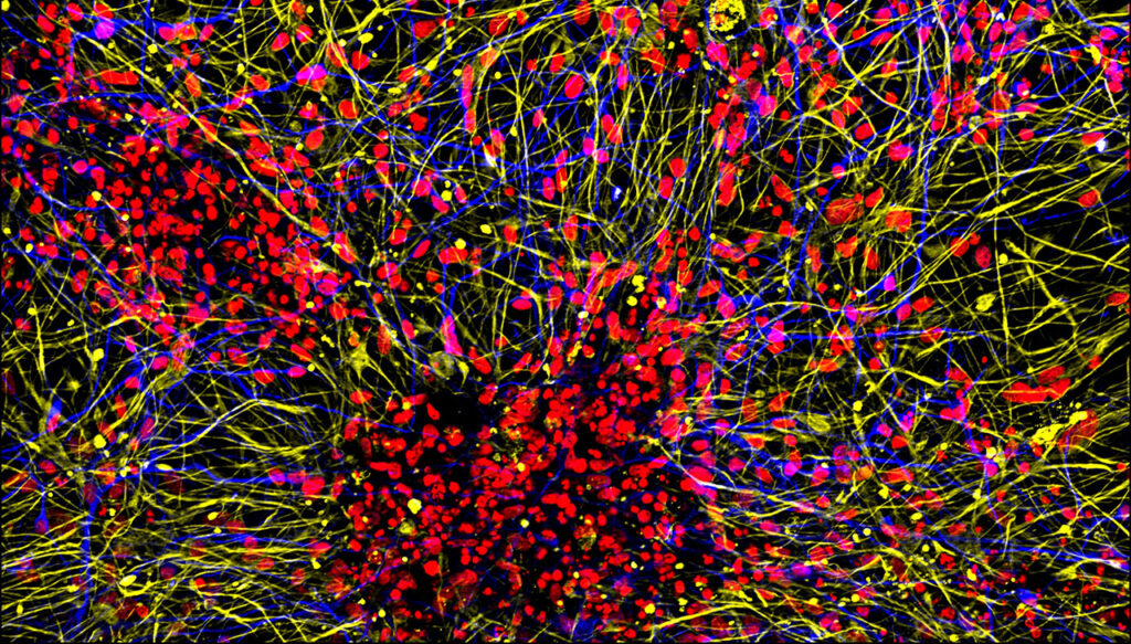 spx29-brain-organoids This image shows projections of neurons (yellow) and astrocytes (blue) from human brain organoids.