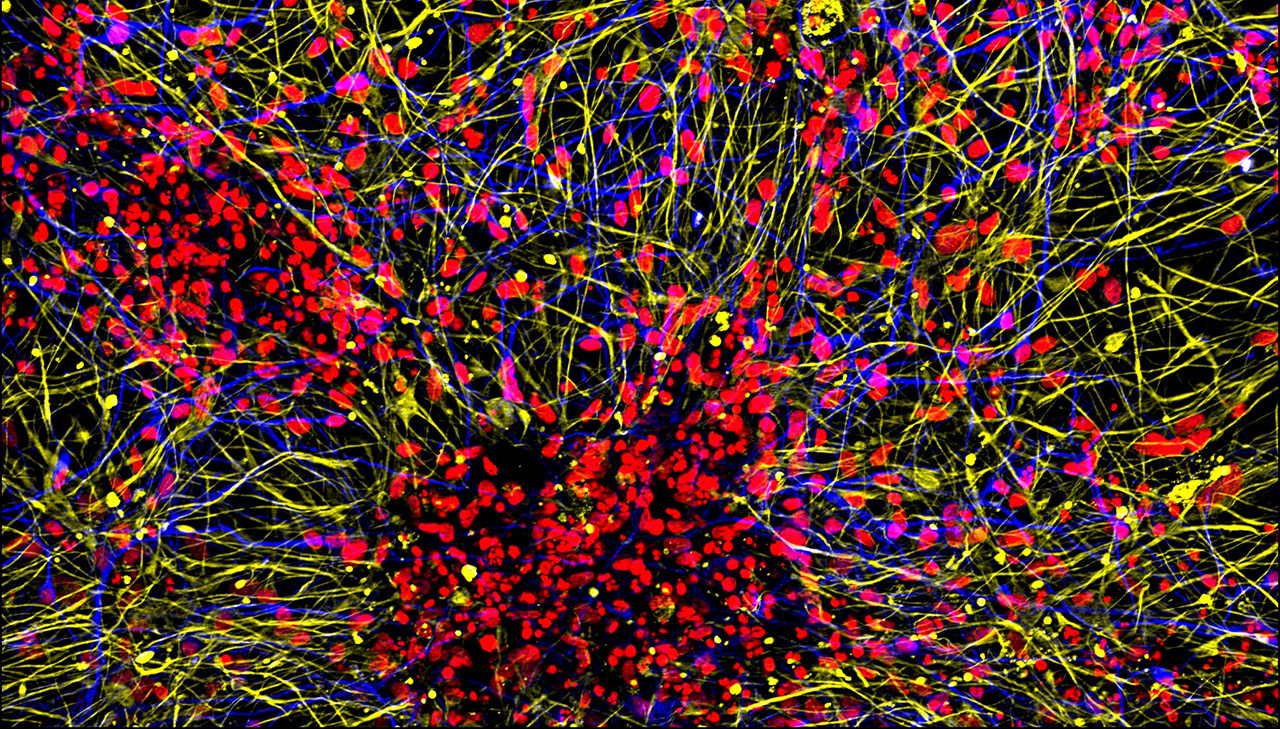 This image shows projections of neurons (yellow) and astrocytes (blue) from human brain organoids.
