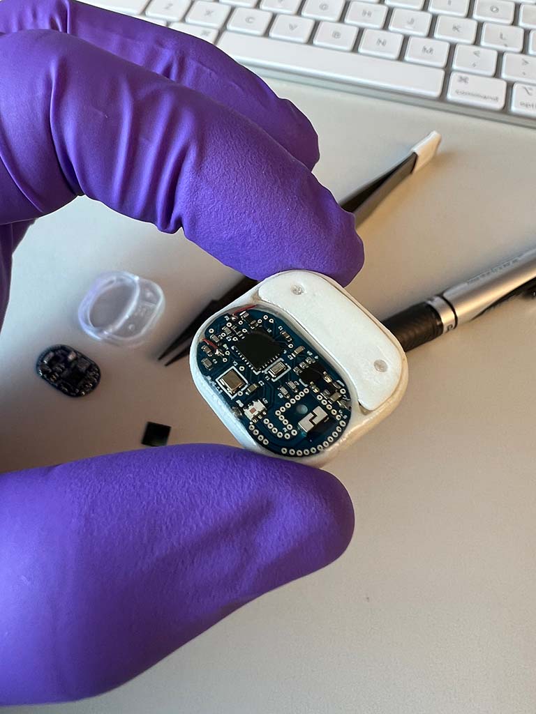 A researcher holds the new remotely controlled drug delivery implant containing computer chip like technology.