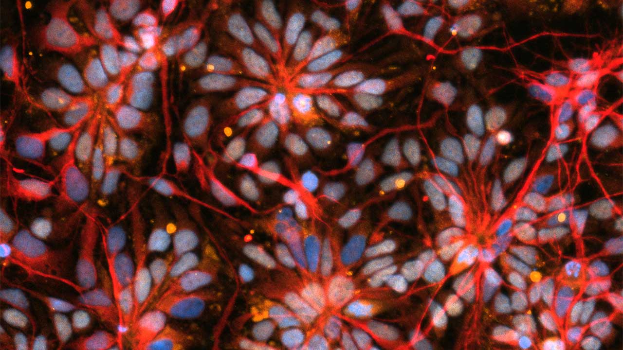 spxcrs30-nyscf-organoid-brain Cells in a brain organoid that was created using cells from people with Parkinson's disease and primary progressive multiple sclerosis