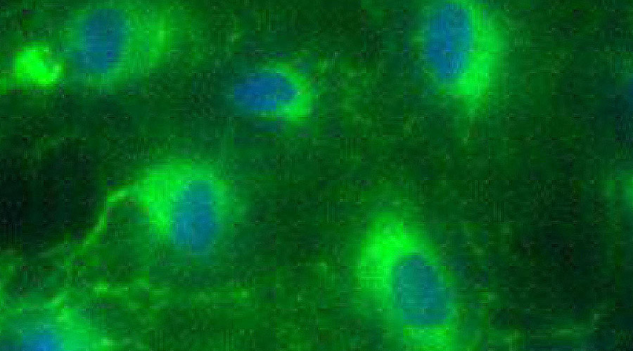 Microscopic image of human stem cells attached and growing on carrier beads.
