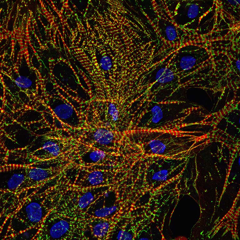 An image of heart cells grown in microgravity aboard the ISS.