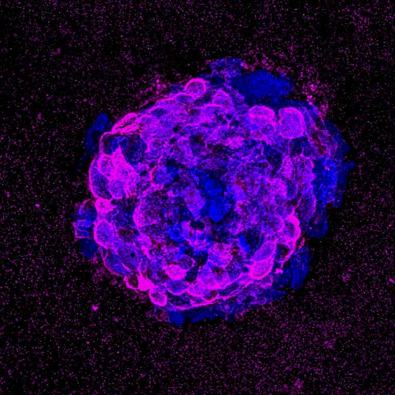 Image from the experiment showing a T cell with impaired wound healing due to immunosenescence.