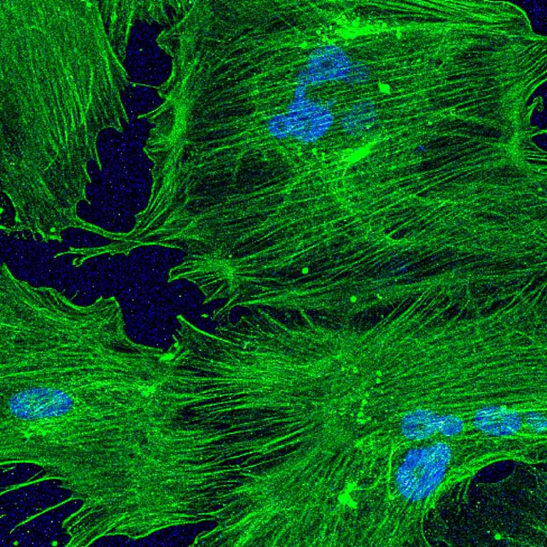 Image from the investigation of healthy mesenchymal stromal cells, which are essential for bone, wound, and cartilage repair.