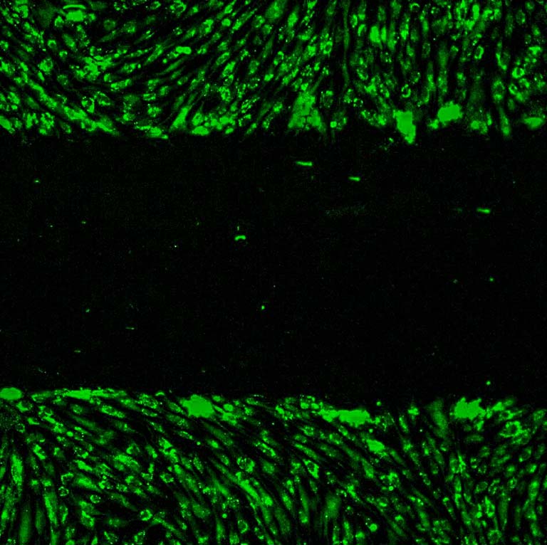 A wound healing assay demonstrates how mesenchymal stromal cells (green) are negatively affected by immune cells in space and are slower to migrate into the black area, which simulates a wound.