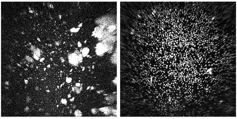 UV imaging of a ground control sample (left) and spaceflight sample (right) from Mercks investigation, clearly showing the much more uniform size and distribution of crystals grown in microgravity.