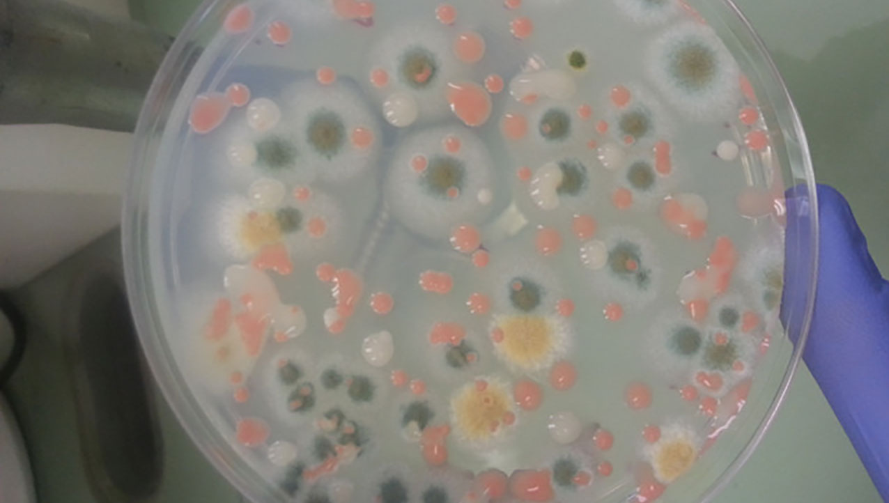 microbial-observation-1 The Microbial Observatory-1 experiment will track and monitor changes to microbial flora over time on the space station.