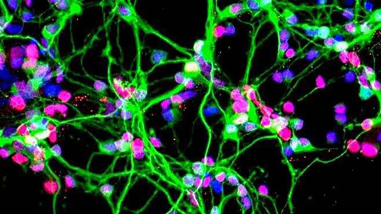 Dopaminergic neurons growing in a culture dish
